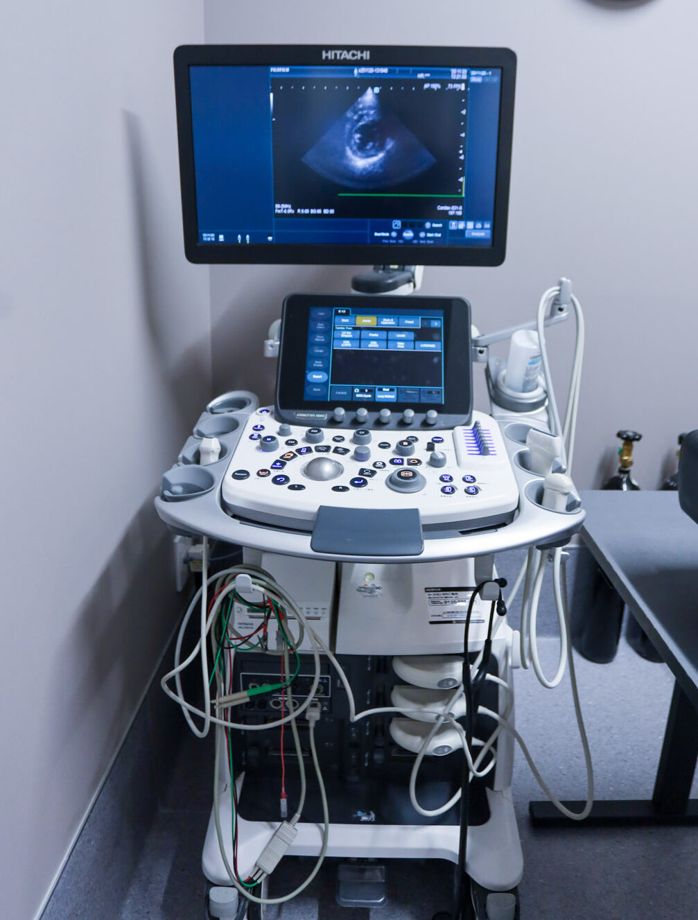 超音波診断装置
FUJIFILM　ARIETTA850